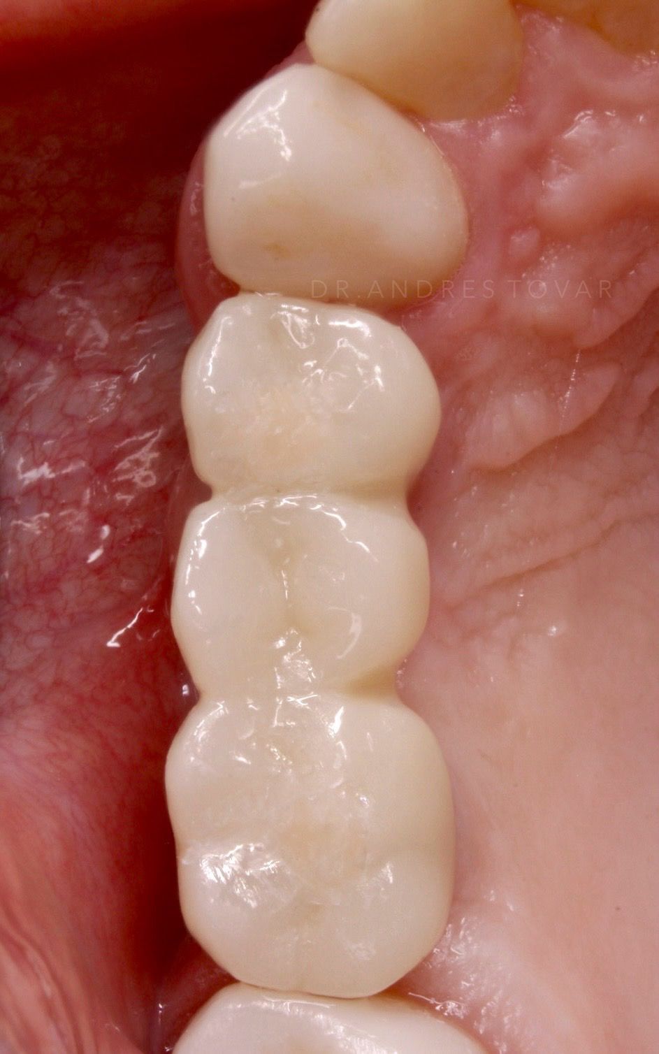 Andrés Tovar López-22