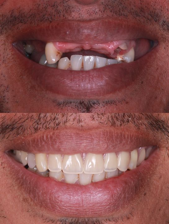 Diana Chacon Cervera-7