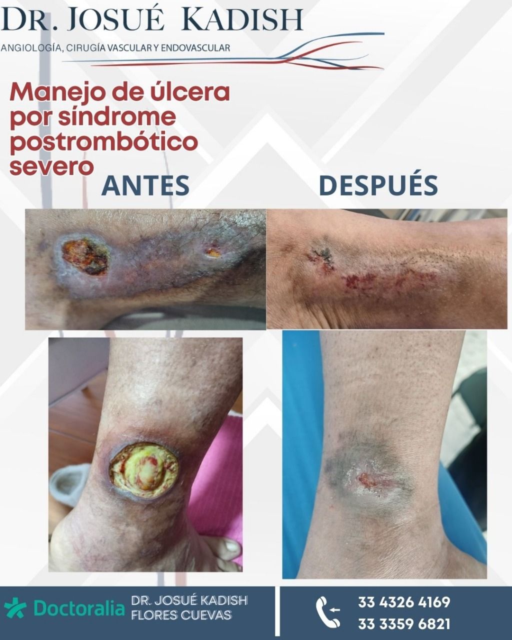 Josue Kadish Flores Cuevas-6