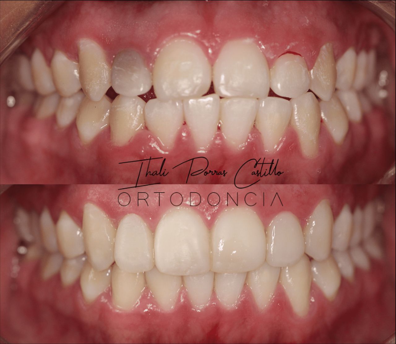 Ihali Porras Castillo-0