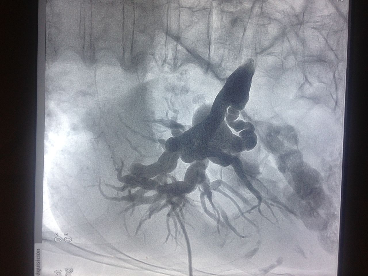 Alfredo Velasquez Maravert.-5