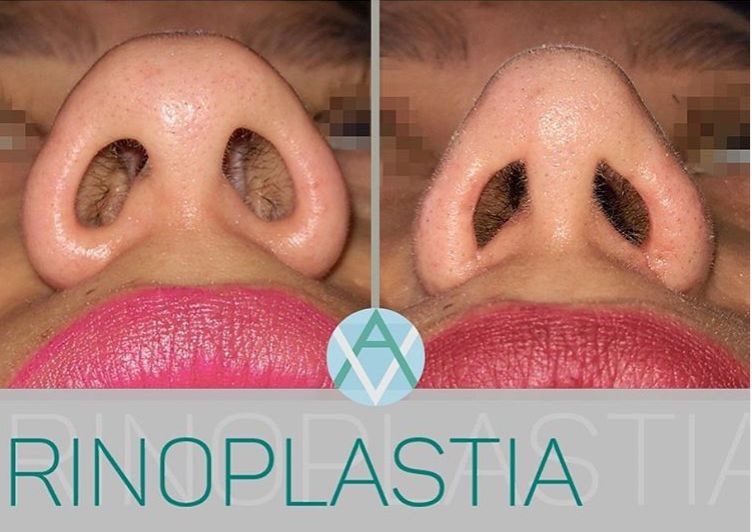 Alfonso Villaseñor Herrero-17