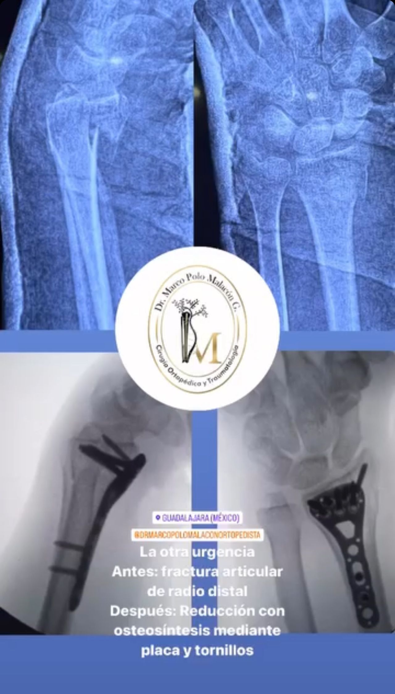 Marco Polo Malacón Gutiérrez-27