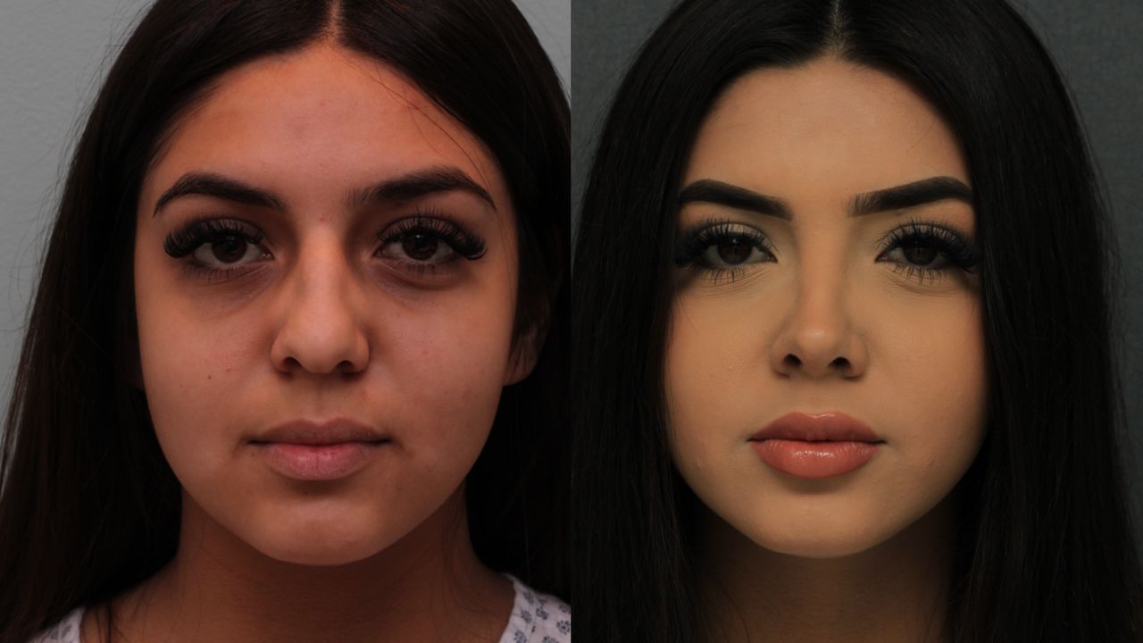 Angel Castro Urquizo-18