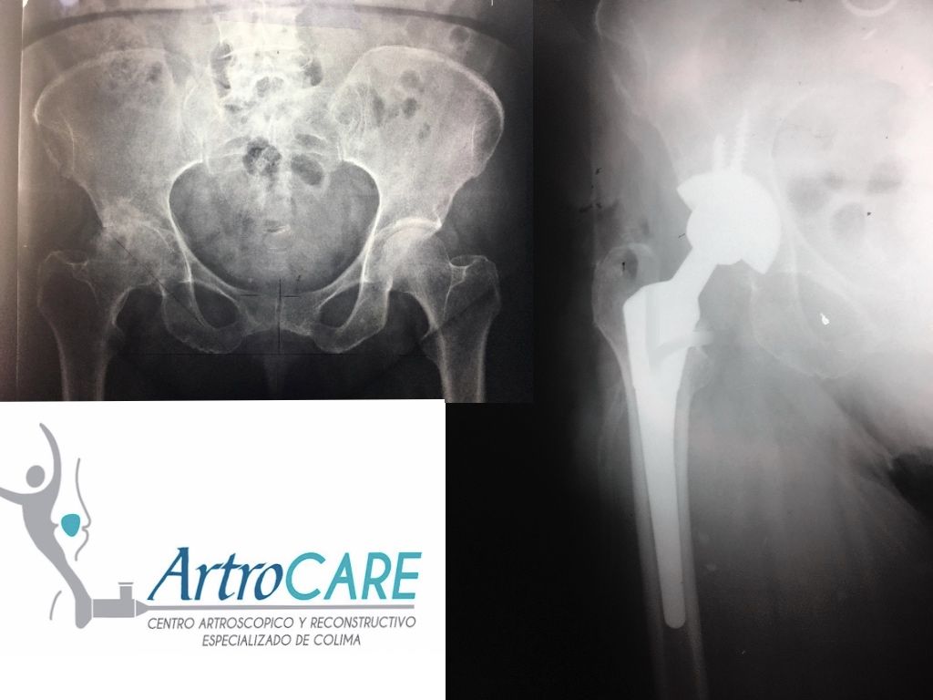 Yonatan Saúl De Santos Quintana-18