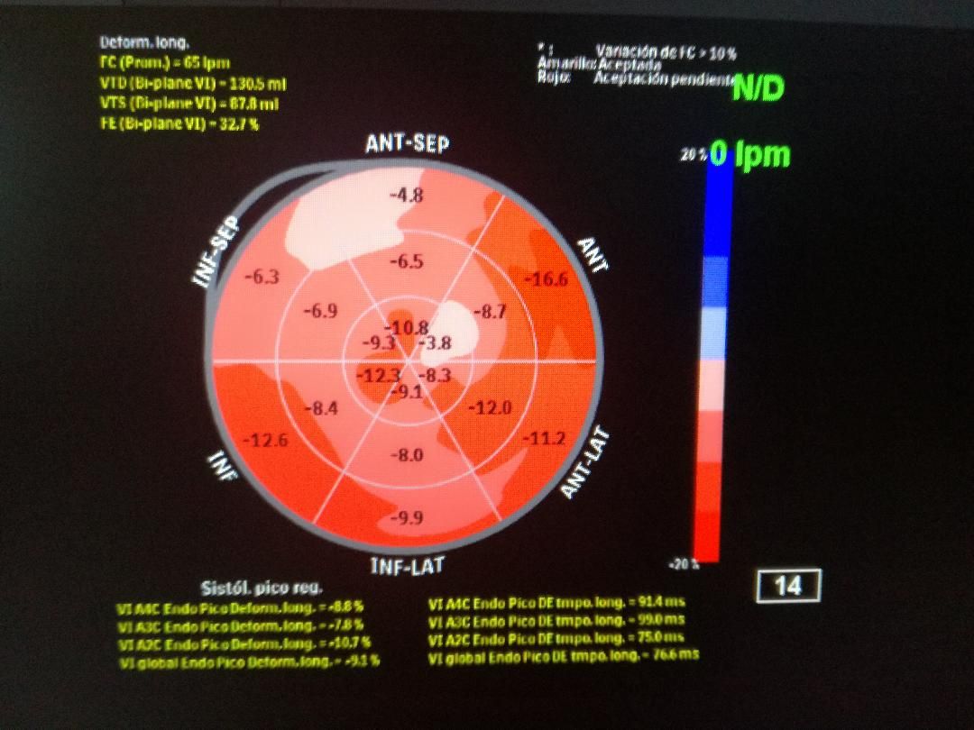 Hugo Velázquez Moreno-4