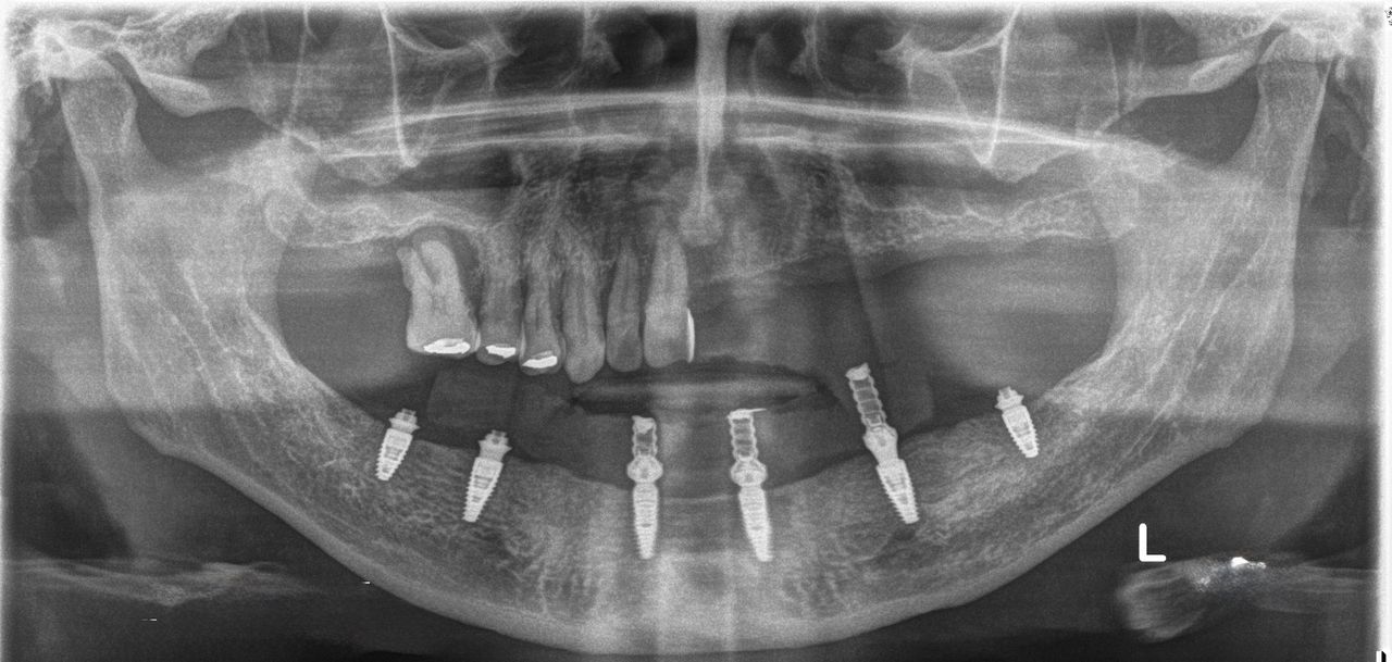 Sergio Cortes Peral-9