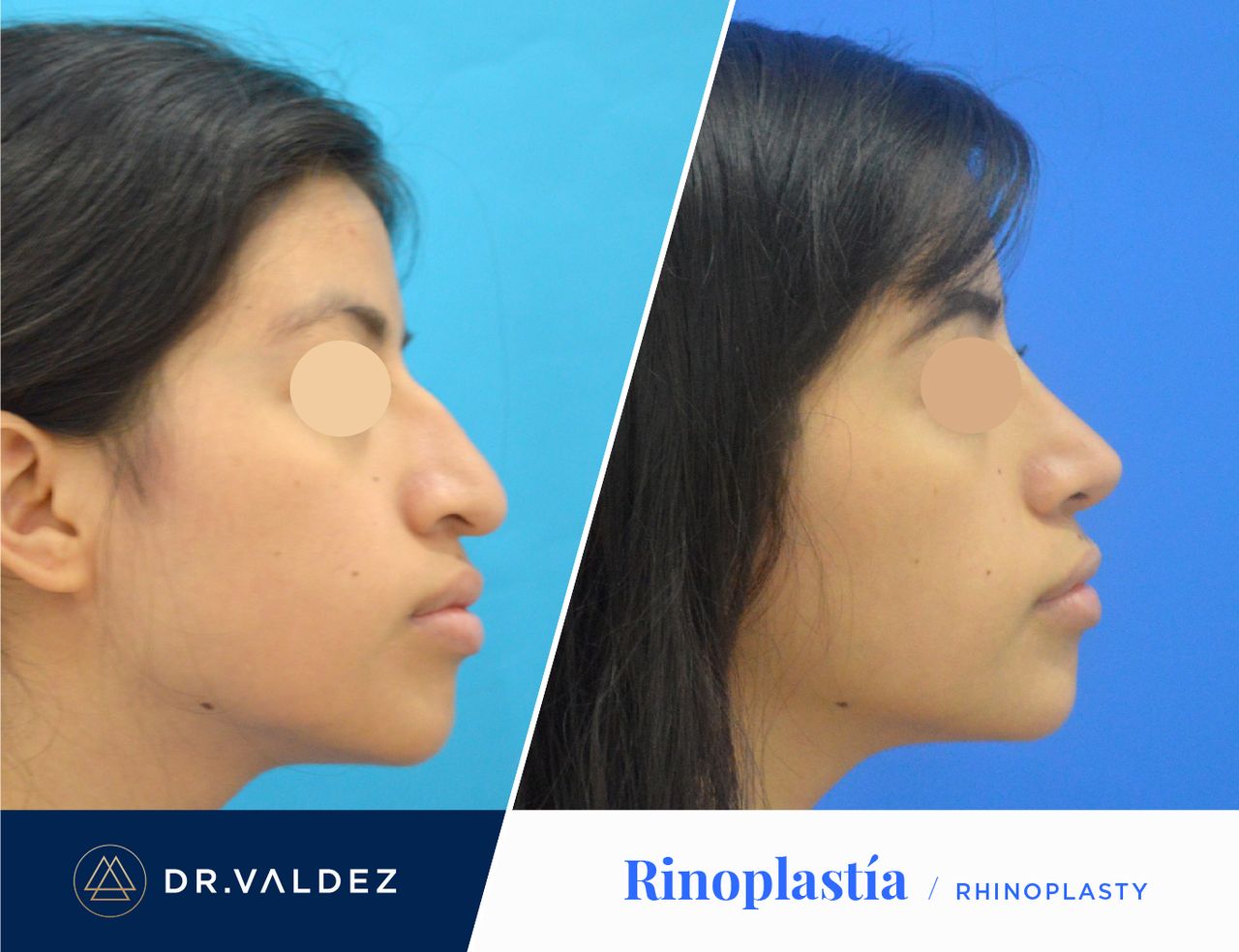 Pedro Arturo Valdez Gomez-10