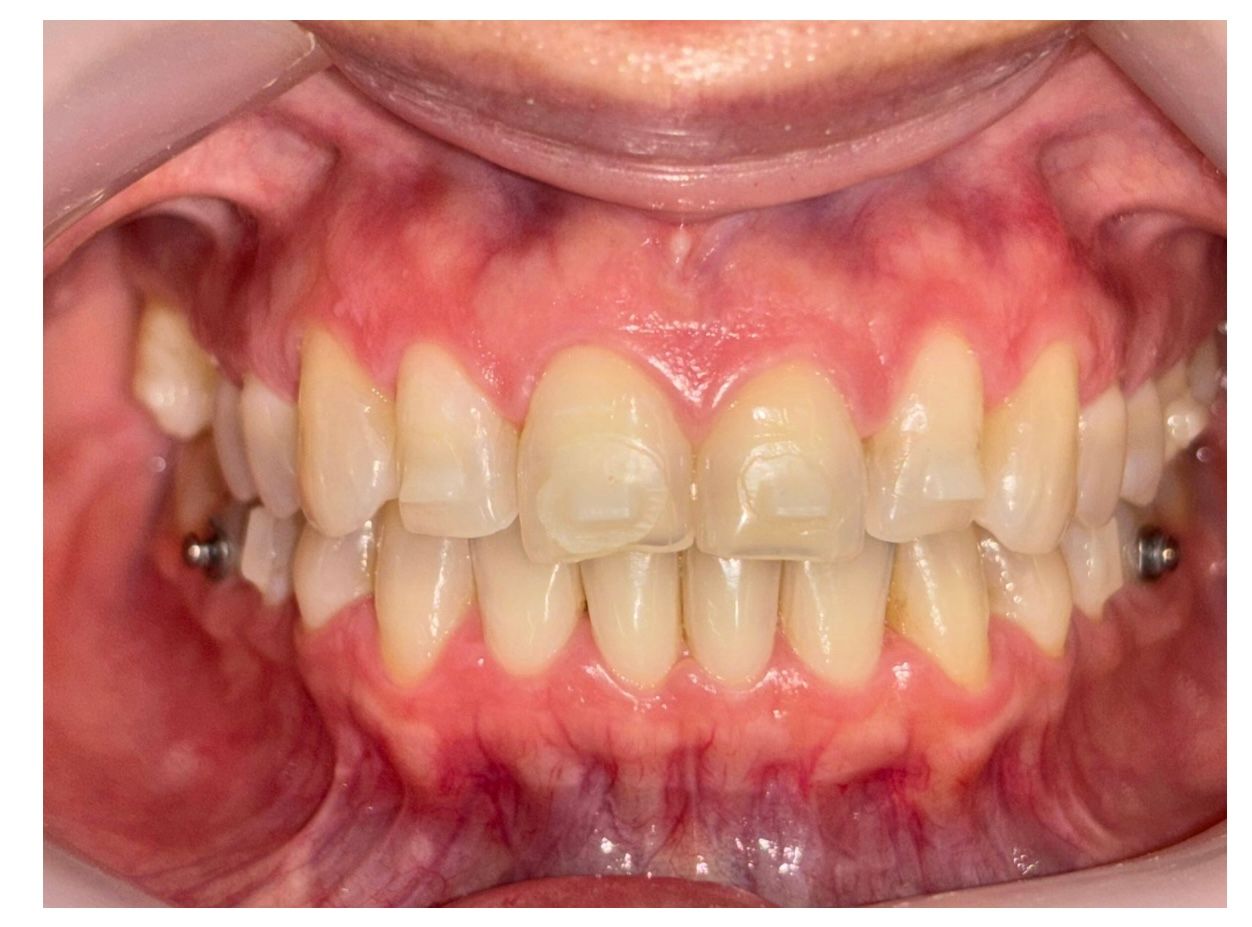 Priscila Berenice Gutiérrez Martínez-2