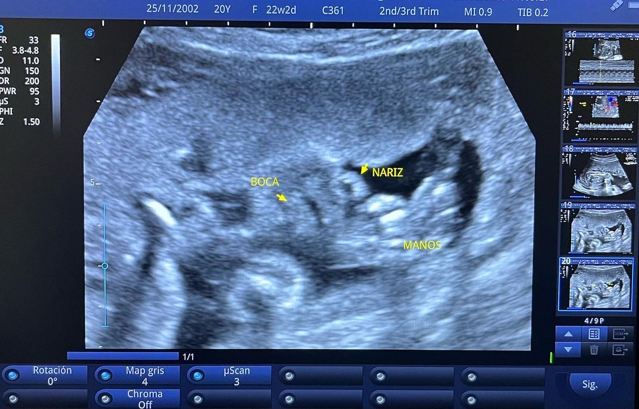 César Guerra Martínez-46