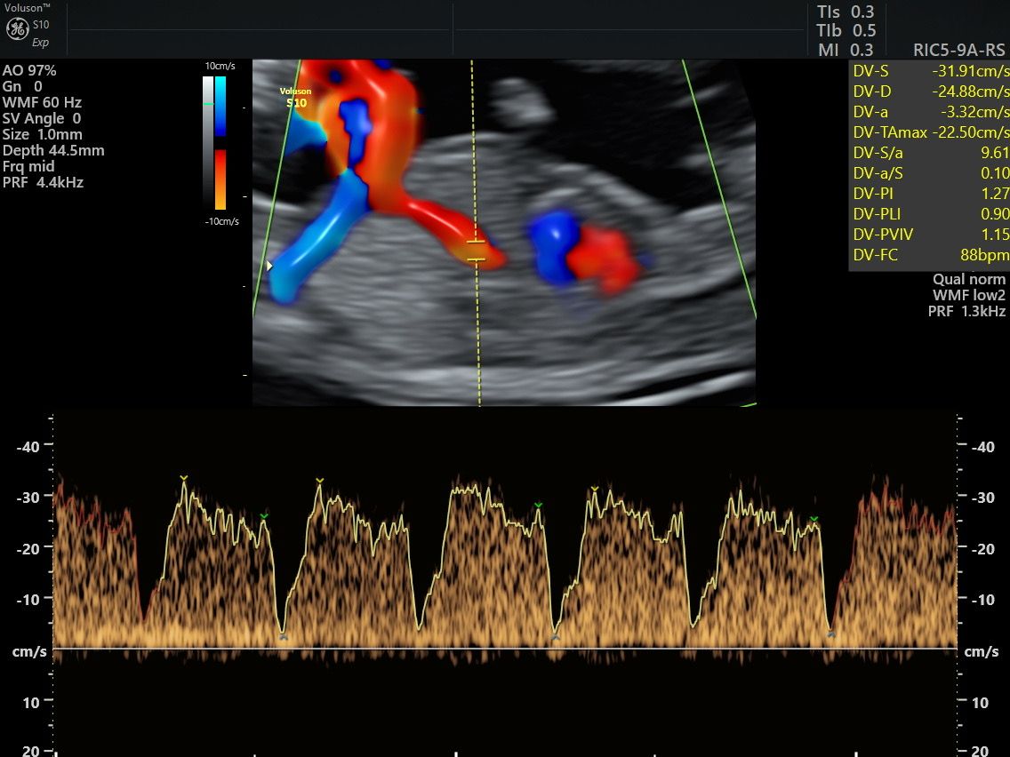 Martín Francisco Pérez Peña-2