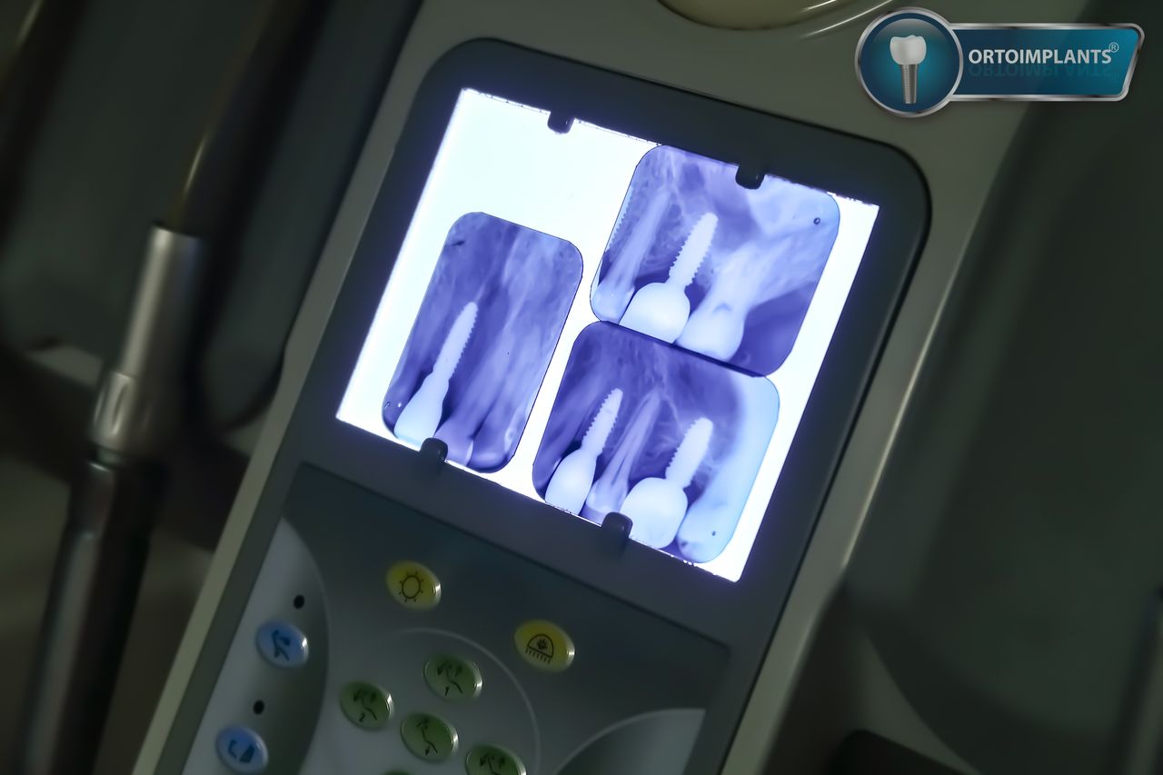 Javier Alejandro López García-11