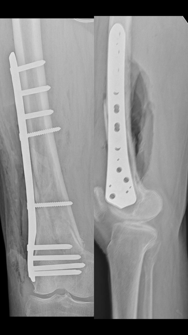 Carlos Humberto Vera Torres-1