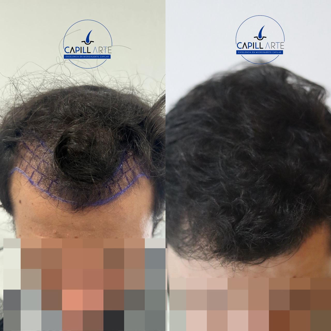 Adrian Hernandez Lopez-3