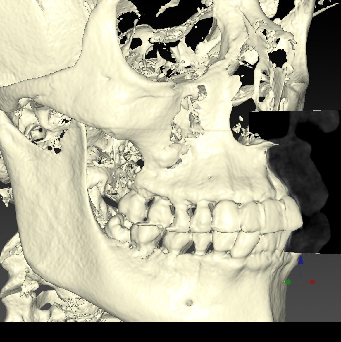 Alberto Wintergerst Fisch-29