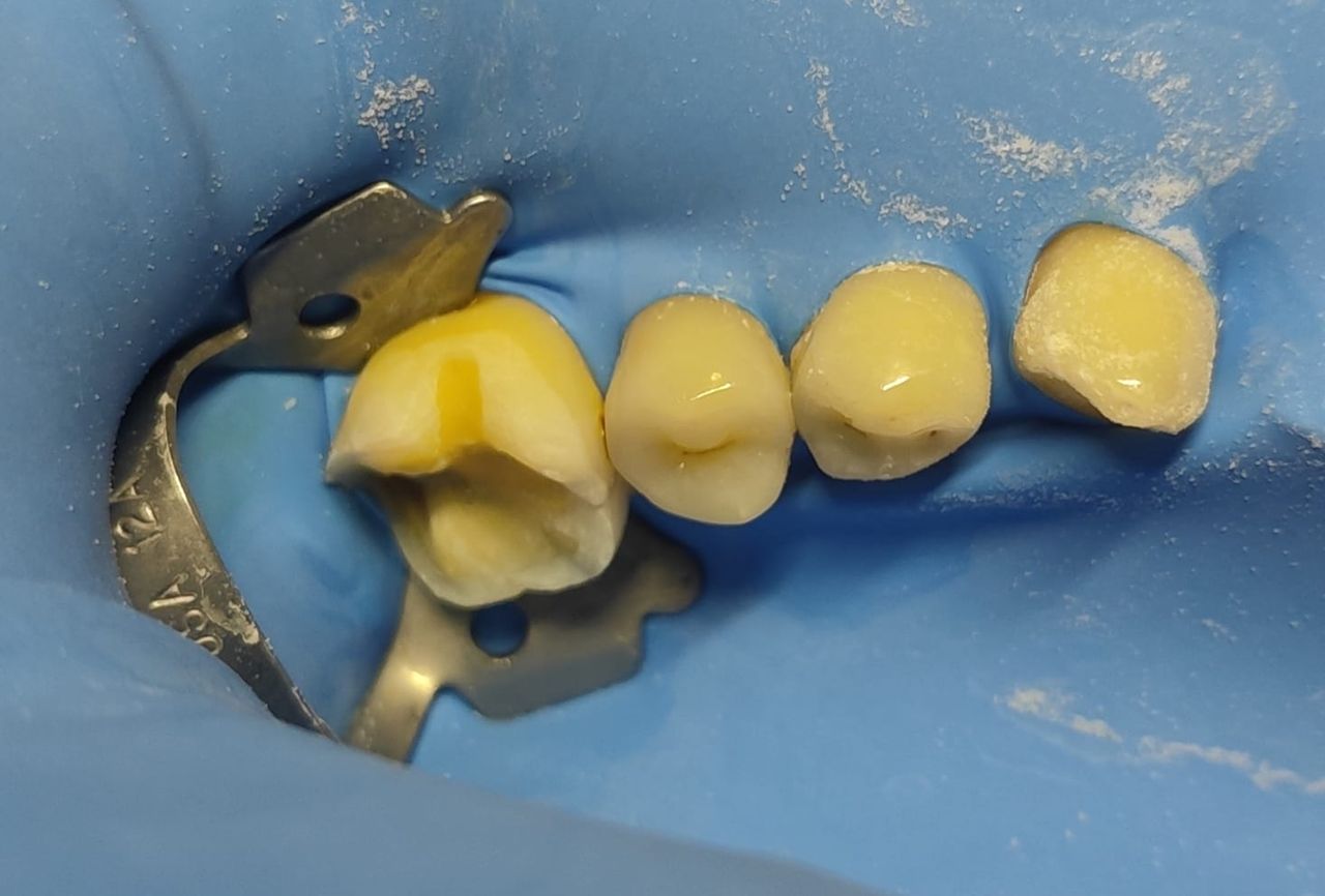 Jonathan Manuel Morán Castell-49