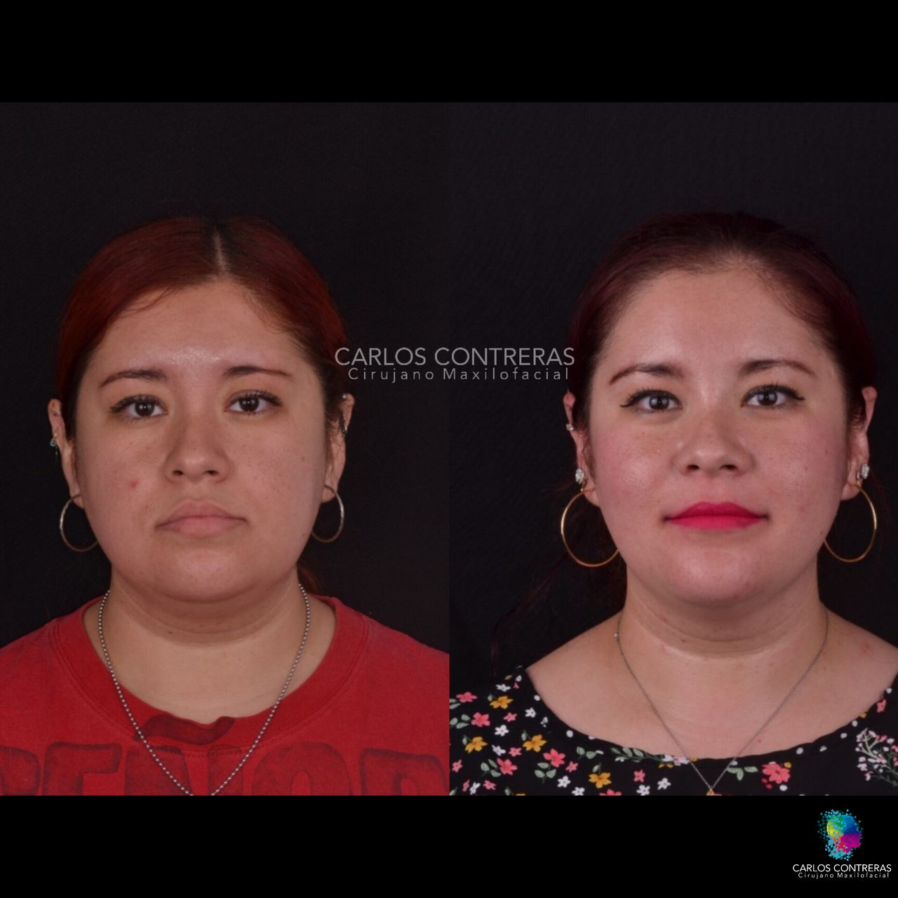 Carlos Ernesto Contreras Castellanos-3