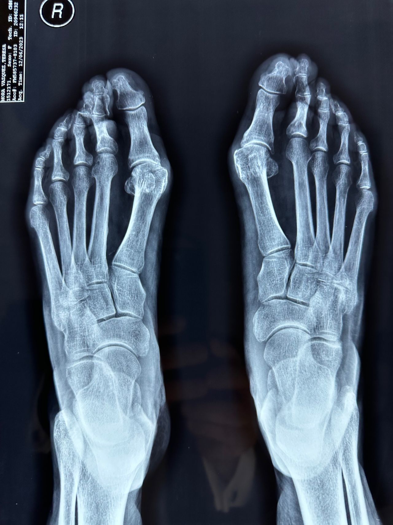 Carlos Ignacio Muñoz Valadez-13