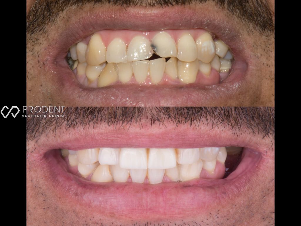 Ulises Pérez Murillo-63