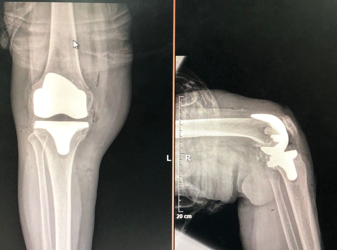 Simón Almanza Mendoza-3