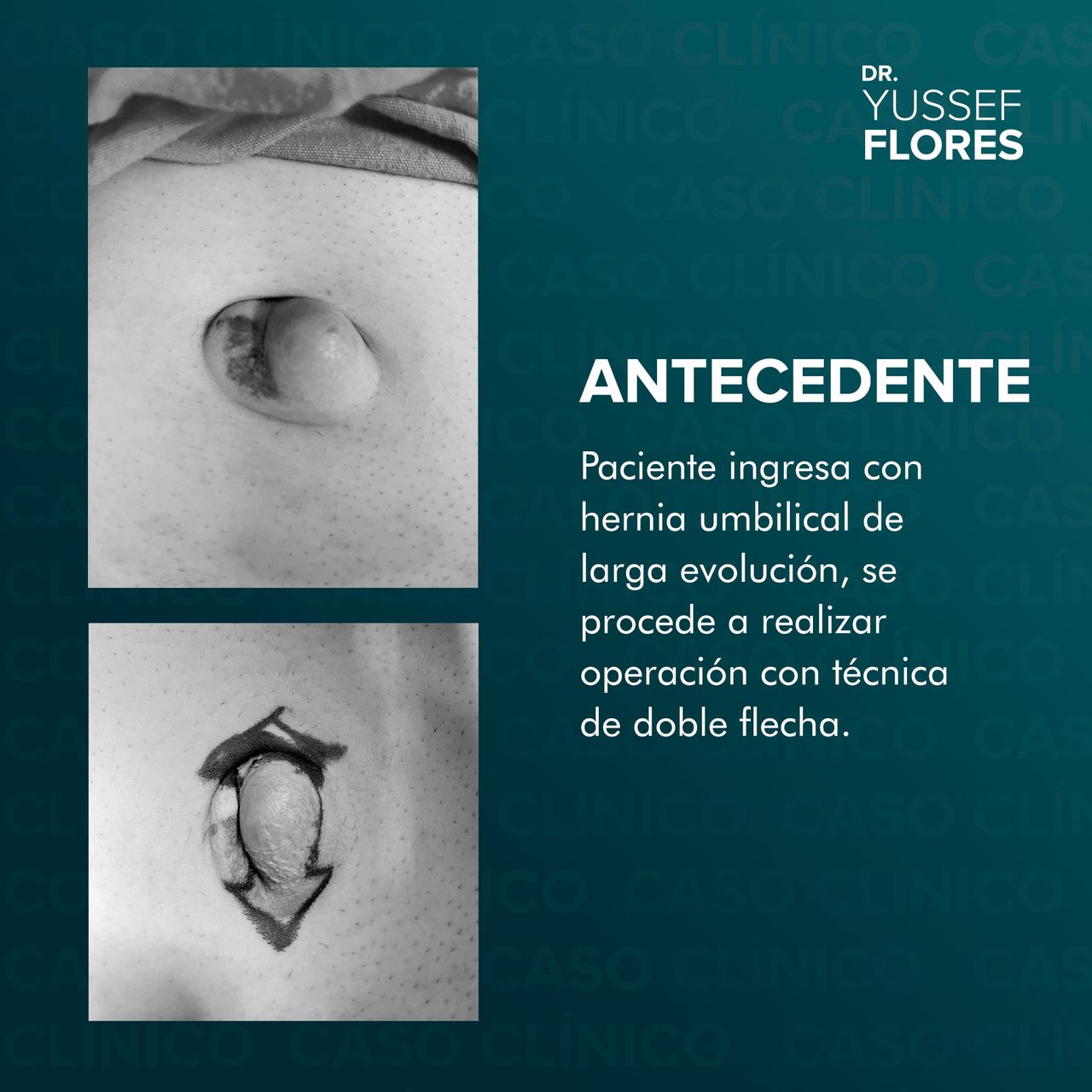 Yussef Flores López-55