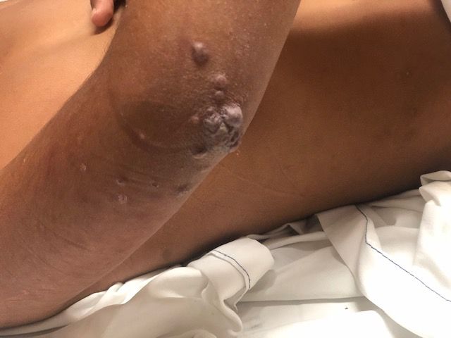 Joel Barroso Santos-50