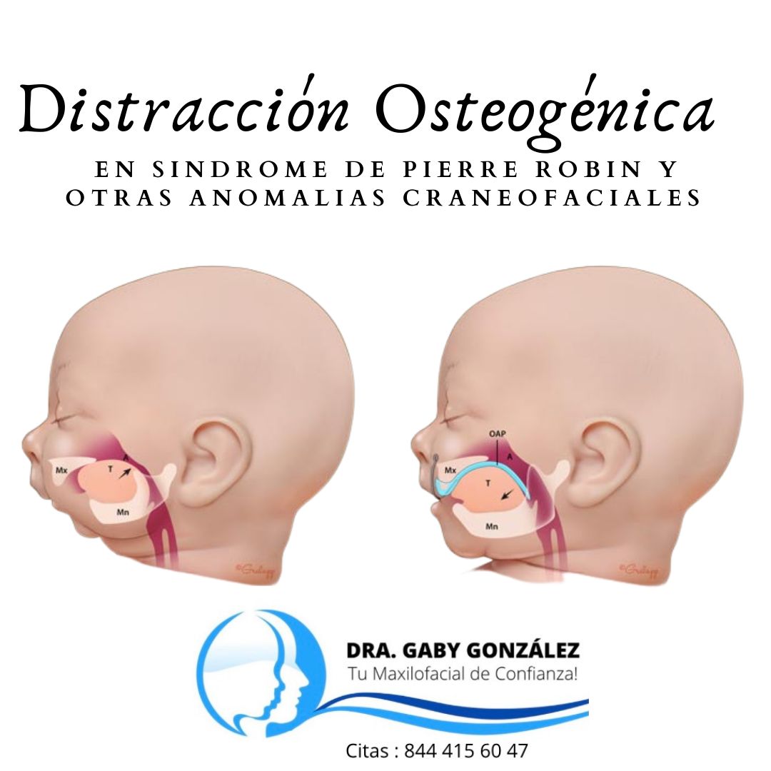 Laura Gabriela González Valdéz-26