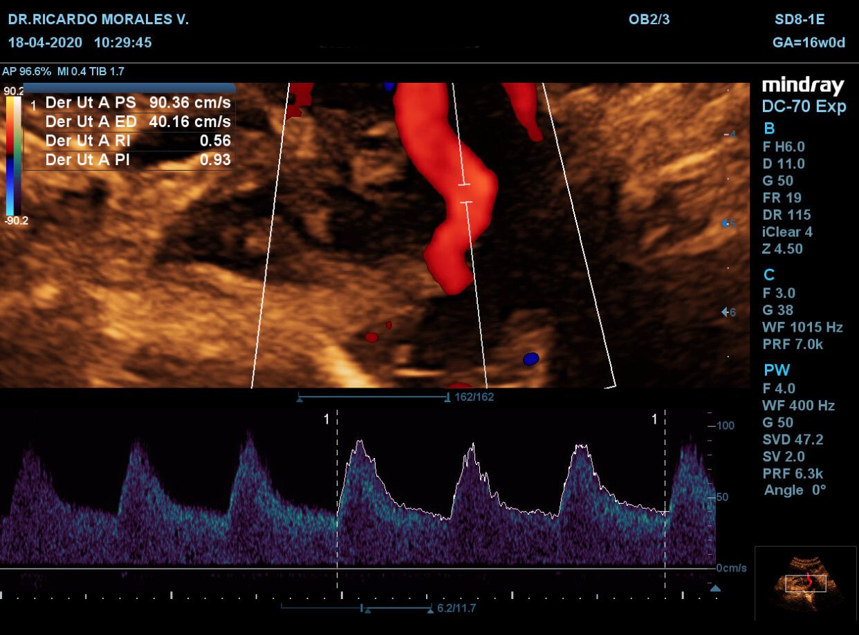 Ricardo Morales Velázquez-7