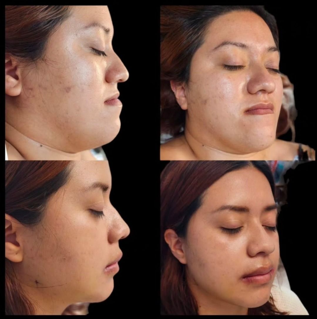 Kevin Matheus Flores Moraz-6