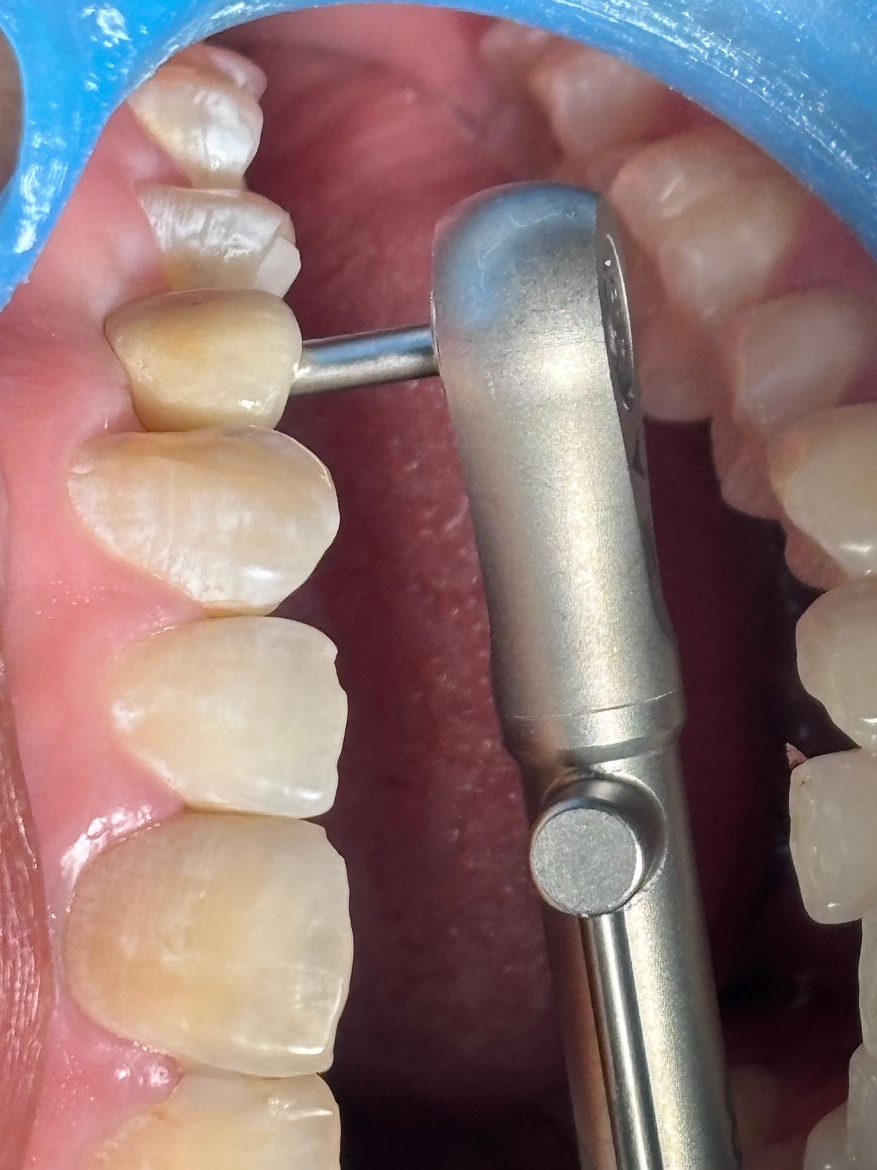 Juan Carlos Estrada Angeles-17