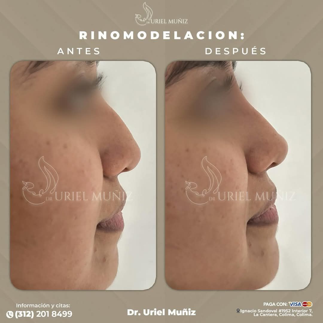 Teófilo Uriel Muñiz Chávez-64