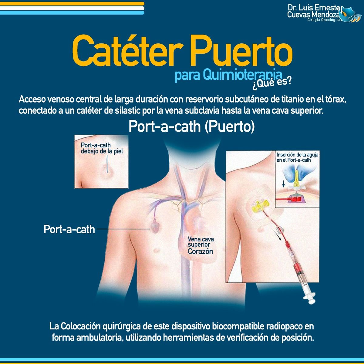 Luis Ernesto Cuevas Mendoza-14