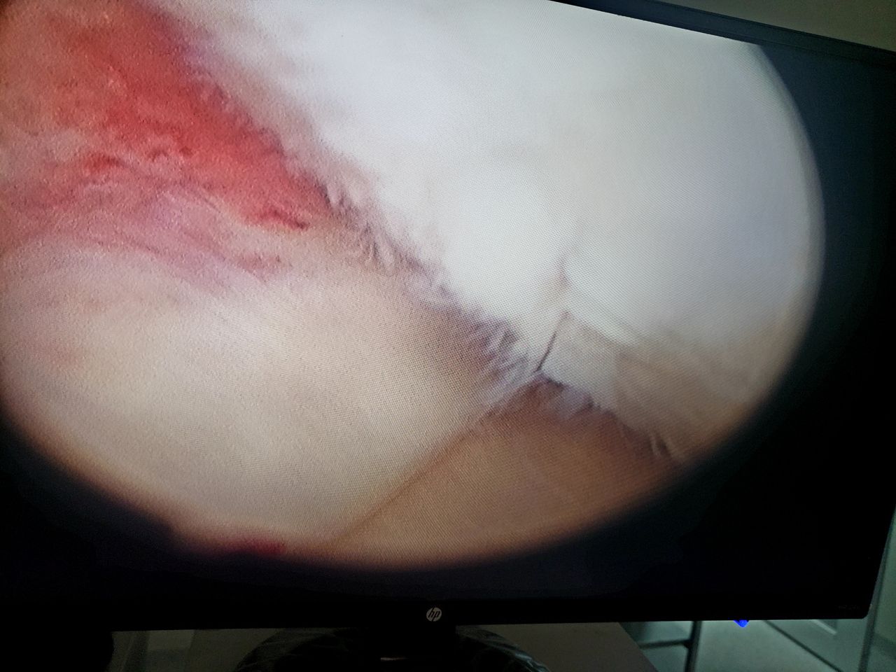 Ramón Adrián Mendias Rincón-2