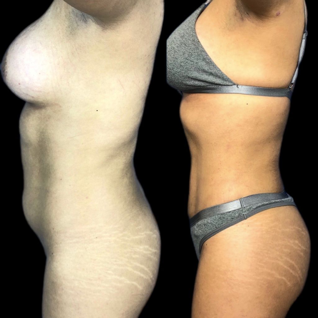 Luis Atilio Gil Pérez-15