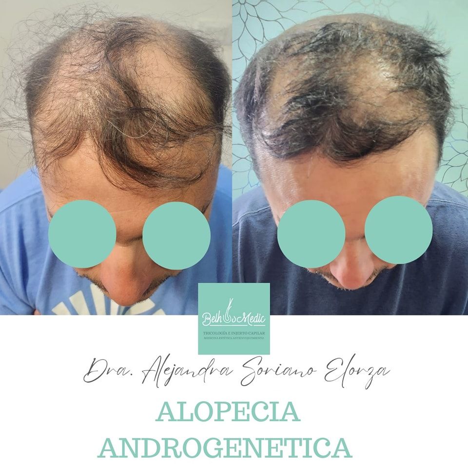 Alejandra Soriano Elorza-60