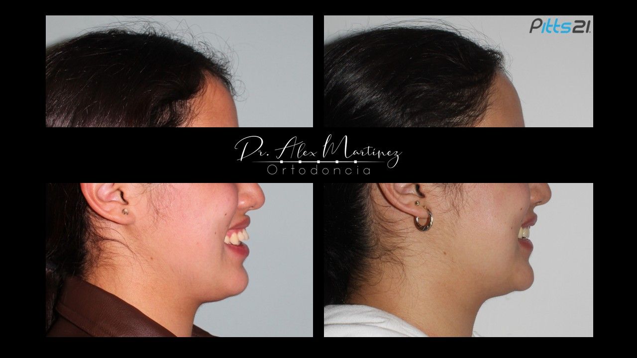 Alejandro Martínez Hernández-13