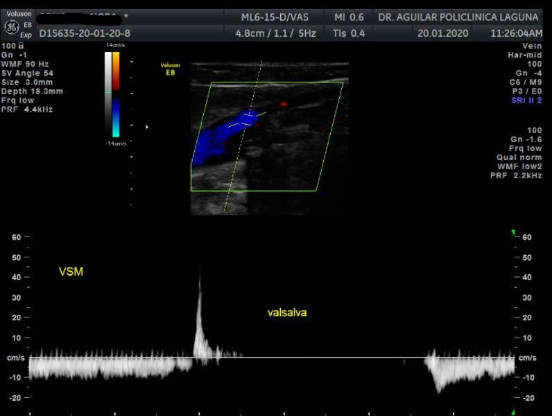 Edgar Fernando Aguilar Morales-11