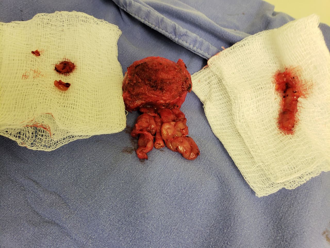 Cesar V. Ignacio Morales-0