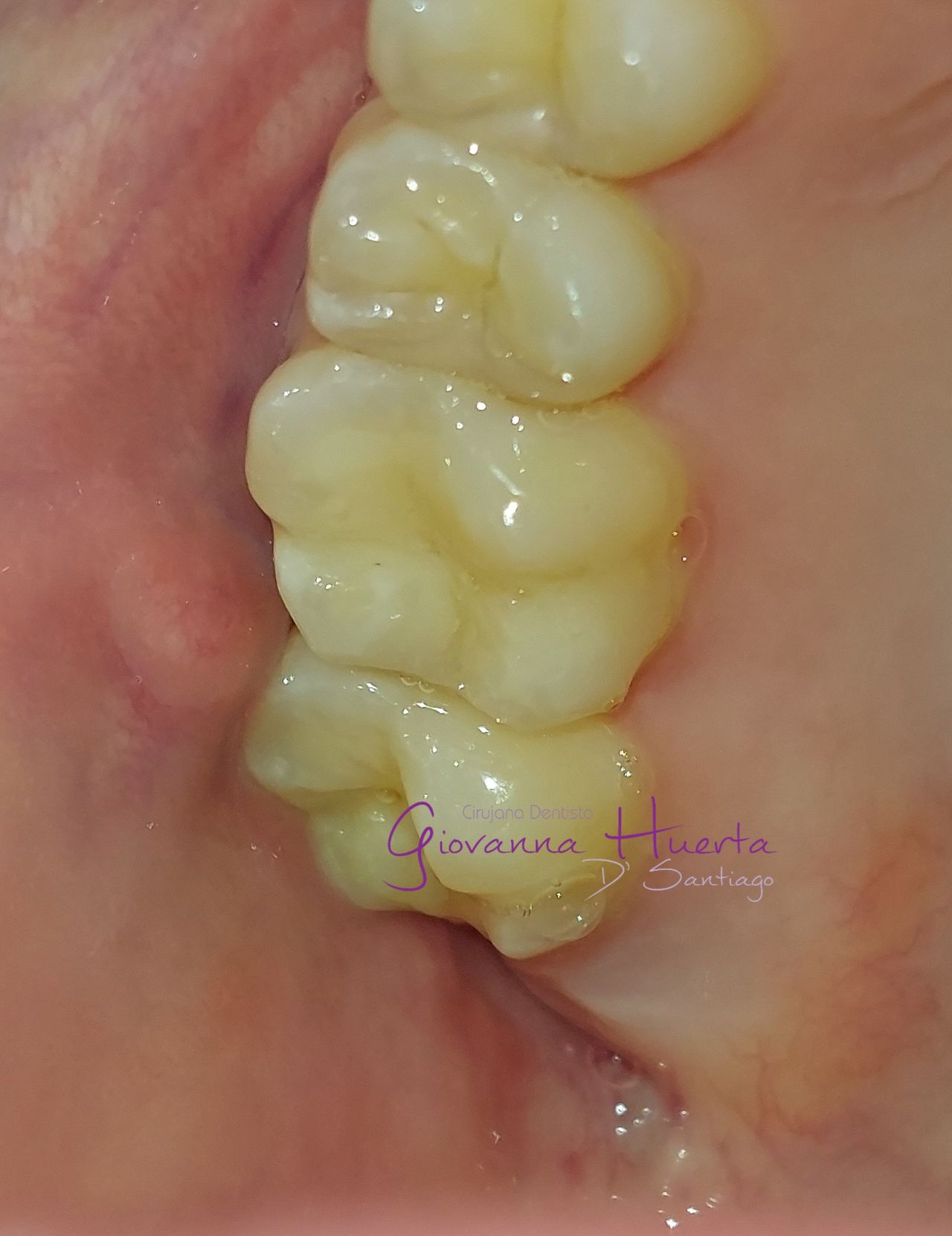 Giovanna Paola Huerta De Santiago-5