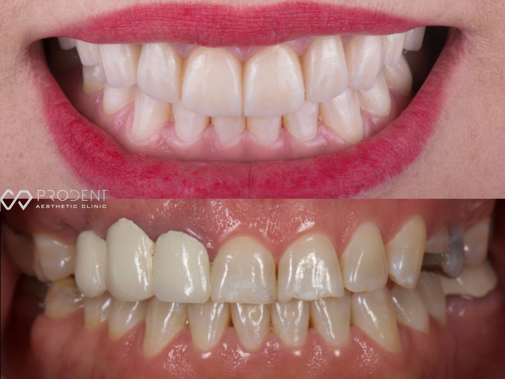 Ulises Pérez Murillo-50