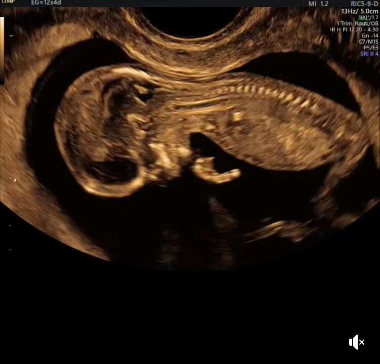 Guadalupe Muñoz Castro-56