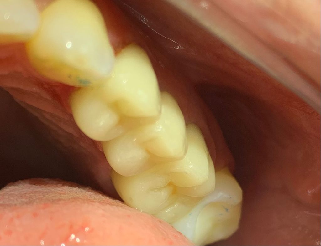 Yuriria Gochy Escalante-4