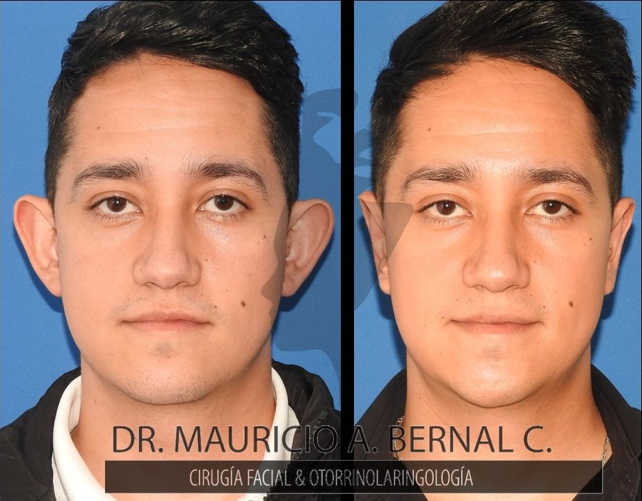 Mauricio Alejandro Bernal Carreon-8