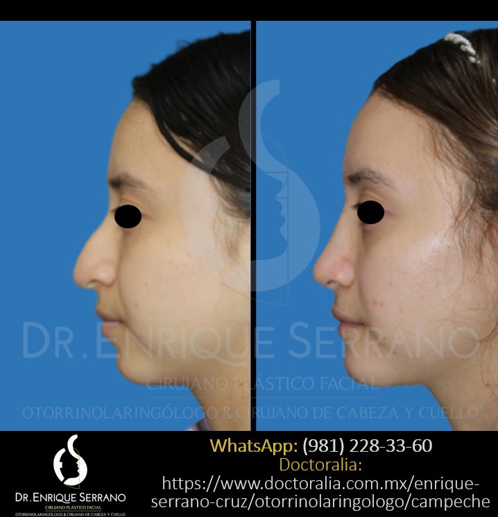 Enrique Serrano Cruz-50