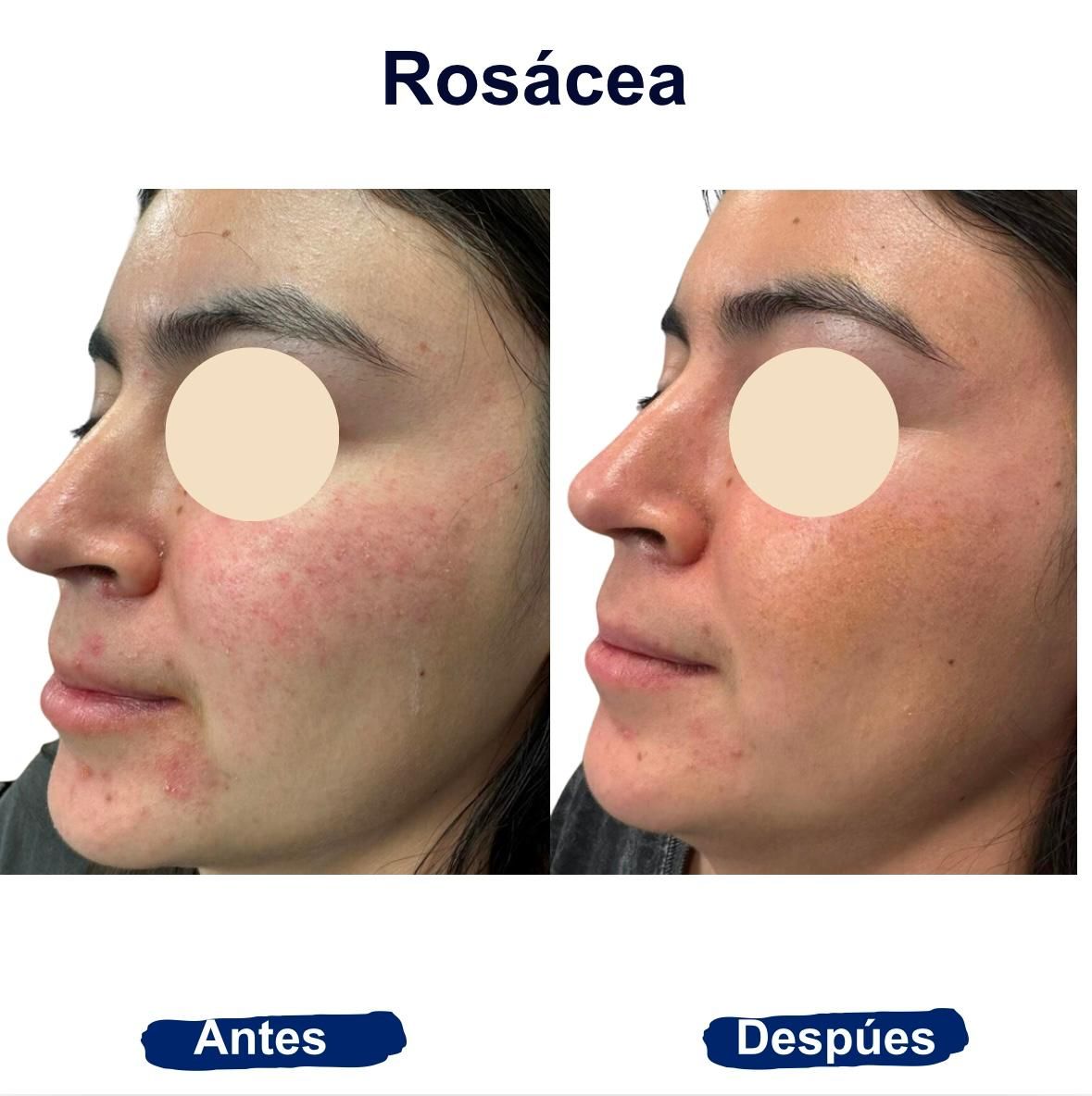 Itzel Anayn Flores Reyes-10