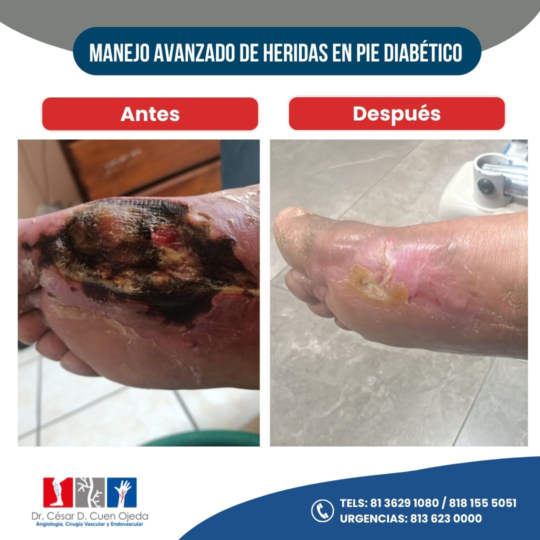 César Daniel Cuen Ojeda-6