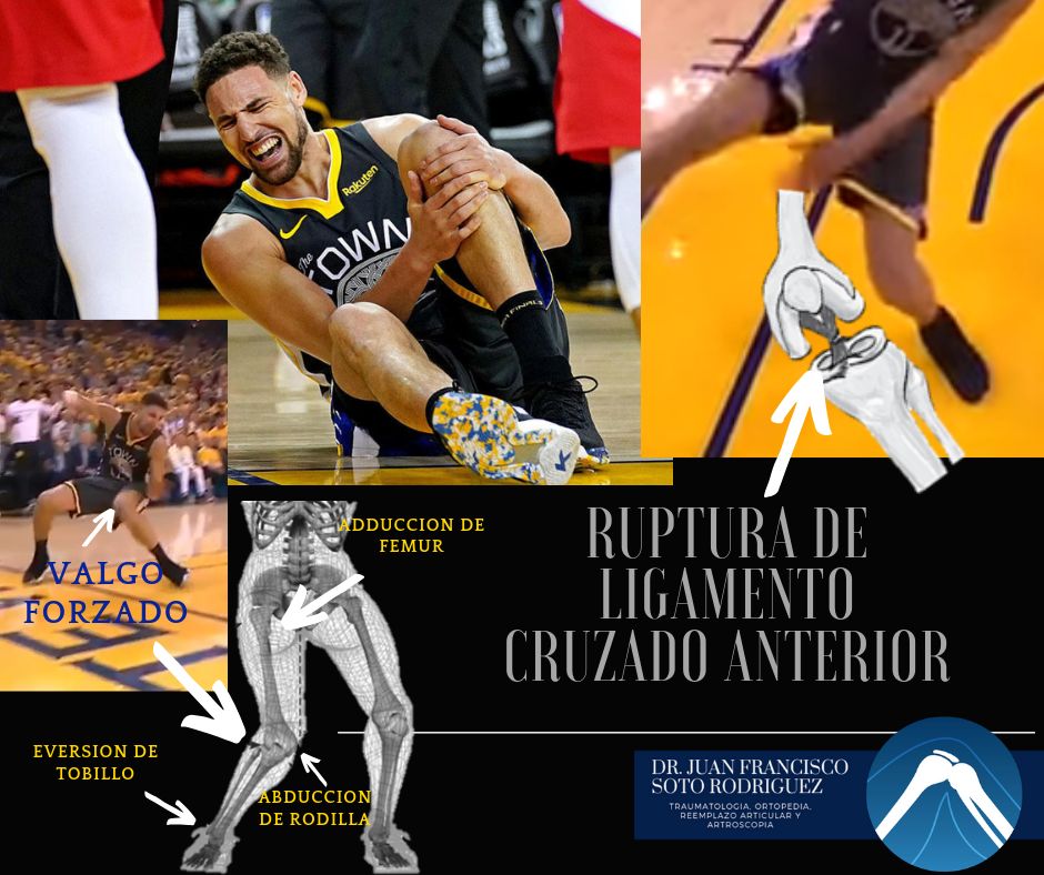 Juan Francisco Soto Rodríguez-2