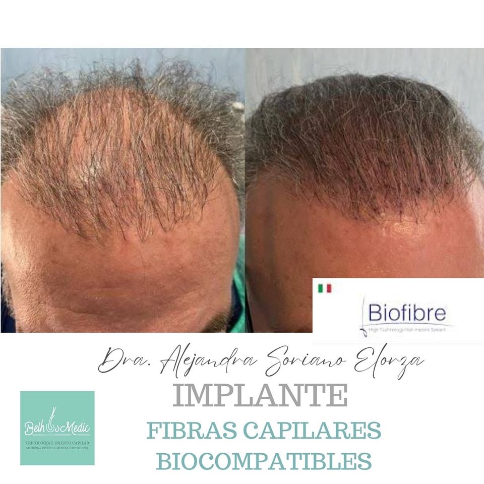 Alejandra Soriano Elorza-63