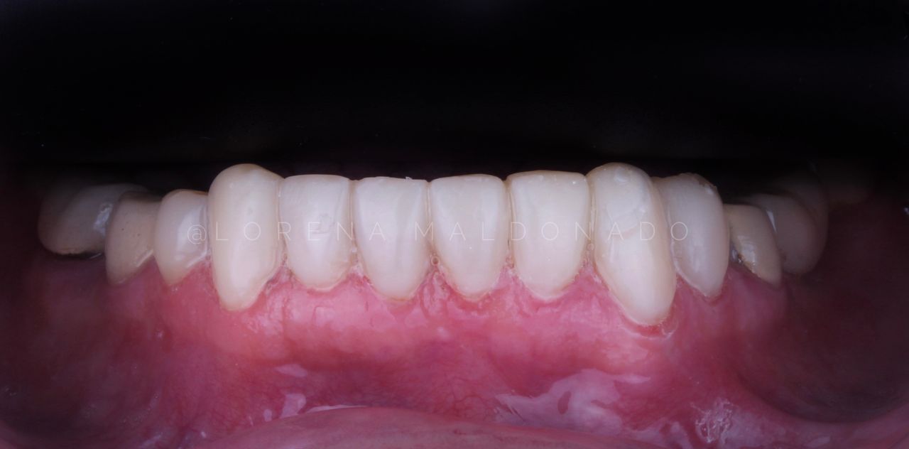 Ana Lorena Maldonado Munguia-12