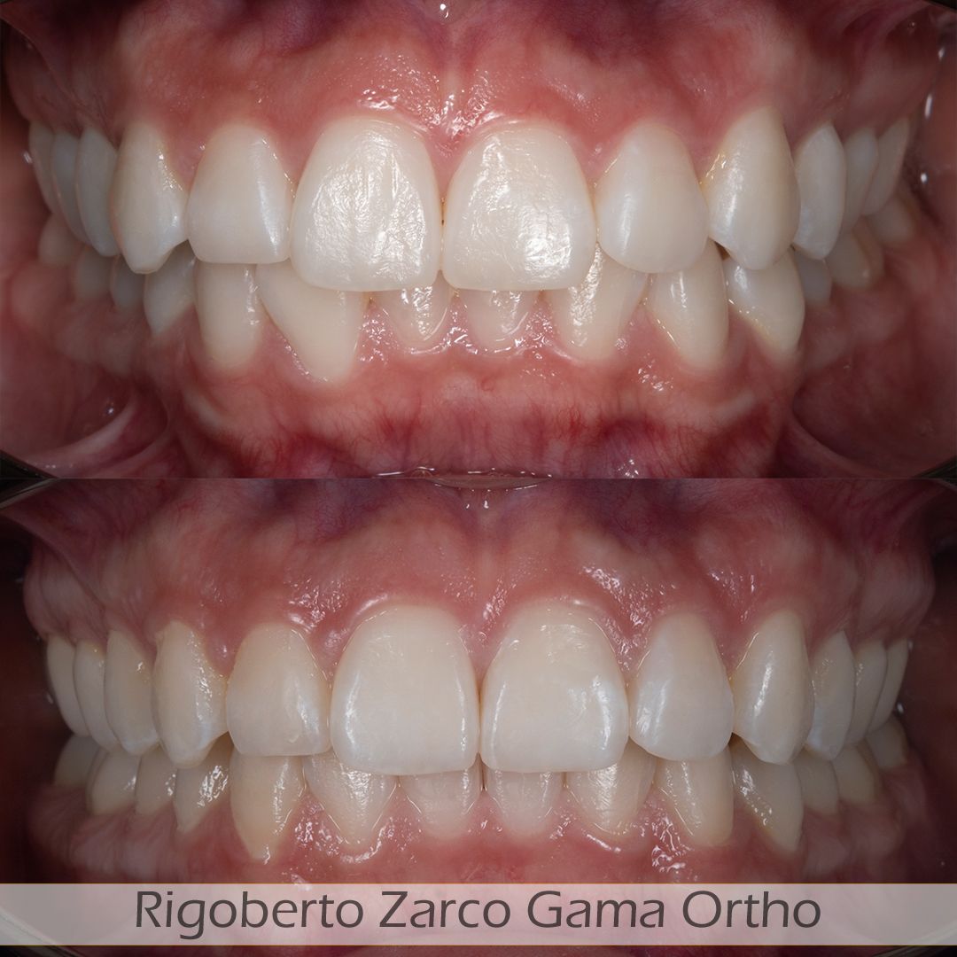 Rigoberto  Zarco Gama-3